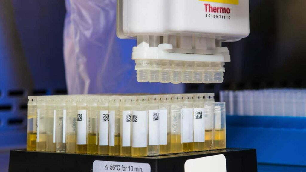 Teströhren gefüllt mit Urin in einer Halterung, über der ein Apparat für Testungen platziert ist. Im Hintergrund sieht man weitere, leere Röhren.